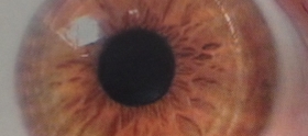 Iridology Scan