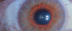 Iridology Scan
